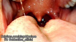 Gummy vore with endo cam