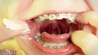 Eating in braces - close up video - food fetish - mouth tour