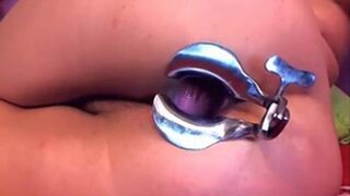 Cam Girl Anal Speculum by M.D.F