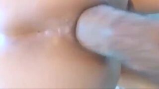 Extreme Anal Fisting Amateurs