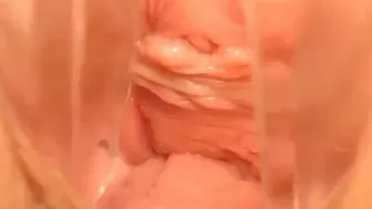Webcam Pussy Play with Speculum