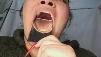 Clips 4 Sale - “Smile of Shame – My Yellow Teeth Up Close Just for You”
