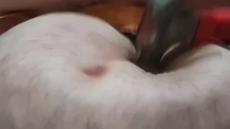 Belly punching
