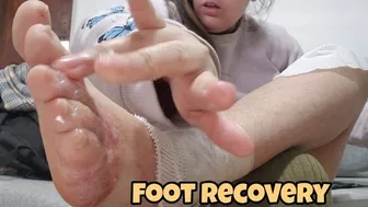 Clips 4 Sale - Foot Bandaging and Itchy Feet Problem – Close-Up Healing and Wrapping Session for Foot Fetishists