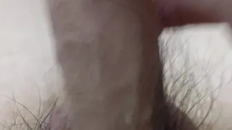 Vietnamese guy masturbates, phimosis.