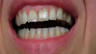 Teeth porn video – Clips 4 Sale - Teeth Pretend To Eat You