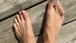 Long, BONY, pretty feet with black BRUISED toe nail