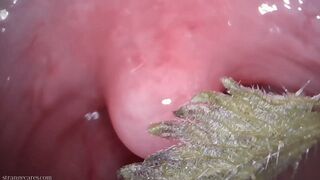 Clips 4 Sale - tongue and uvula stinging nettles