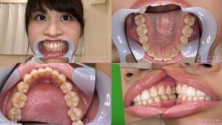Shiori - Watching Inside mouth of Japanese cute girl bite-241-1