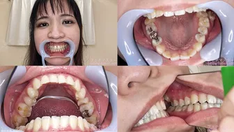 Clips 4 Sale - Rin - Watching Inside Mouth Of Japanese Cute Girl Bite-239-1 - Wmv 1080p