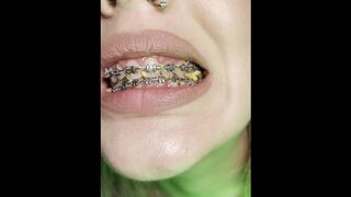Food chewing by braces