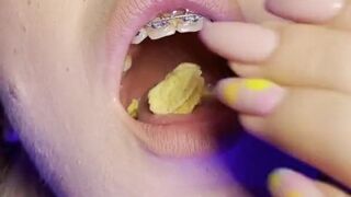 Food chewing by braces