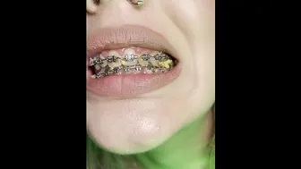 Cum on braces