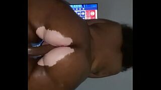 Vitiligo Instagram model Liyahthebunni oiled ass