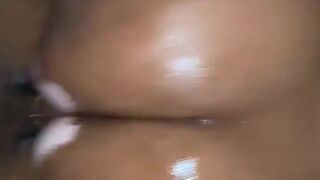 Vitiligo Instagram model Liyahthebunni oiled ass